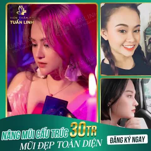 NÂNG MŨI CẤU TRÚC 30TR